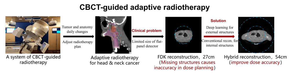 Deep learning CBCT FOV extension for adaptive radiotherapy