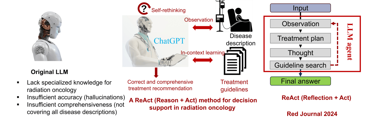 LLM-based decision support for radiation oncology